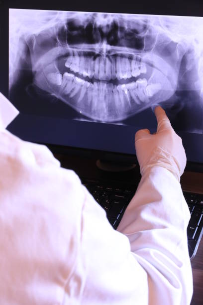 Best Emergency Denture Repair in Monrovia, CA